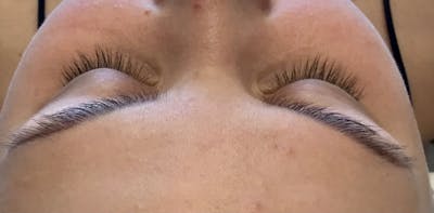 Eyelash Extensions Before & After Gallery - Patient 143511059 - Image 1