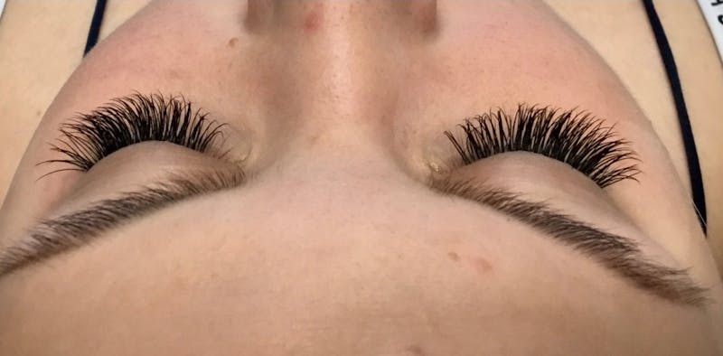 Eyelash Extensions Before & After Gallery - Patient 143511059 - Image 2