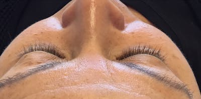 Eyelash Extensions Before & After Gallery - Patient 143511061 - Image 1