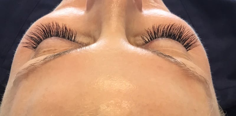 Eyelash Extensions Before & After Gallery - Patient 143511062 - Image 2