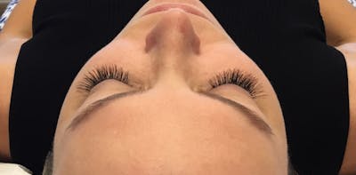 Eyelash Extensions Before & After Gallery - Patient 143511065 - Image 2
