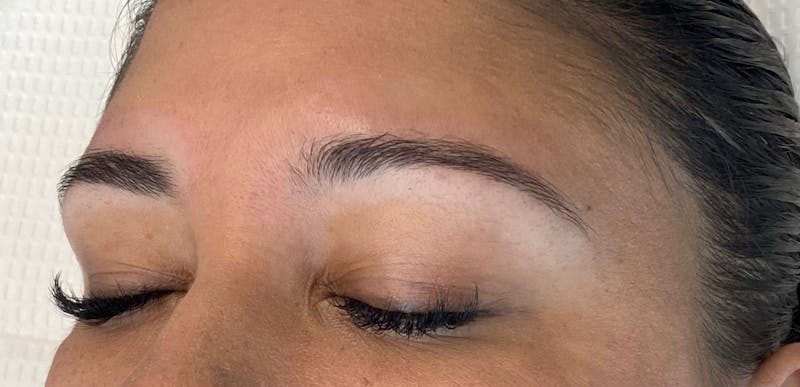 Microblading Before & After Gallery - Patient 143521834 - Image 1