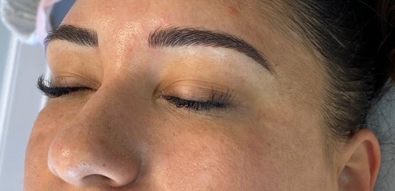 Microblading Before & After Gallery - Patient 143521834 - Image 2