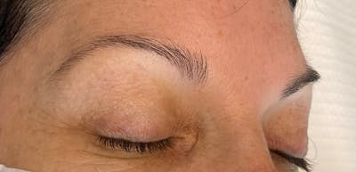 Microblading Before & After Gallery - Patient 143521847 - Image 1