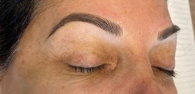 Microblading Before & After Gallery - Patient 143521847 - Image 2
