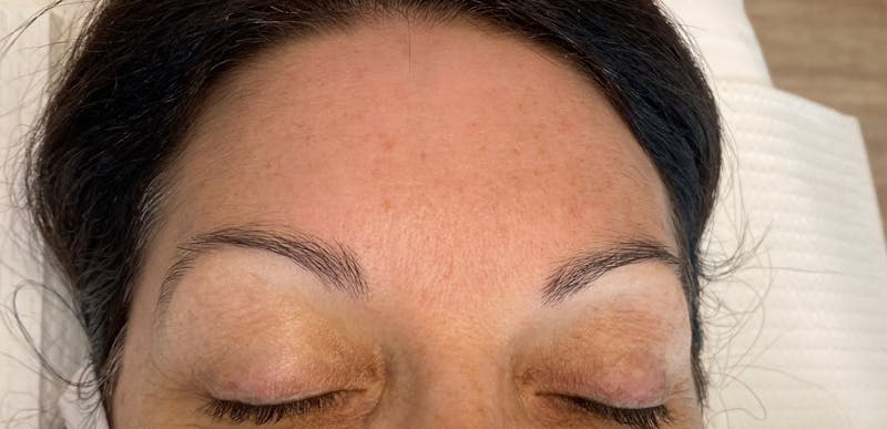 Microblading Before & After Gallery - Patient 143521850 - Image 1
