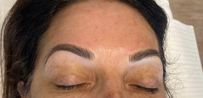 Microblading Before & After Gallery - Patient 143521850 - Image 2