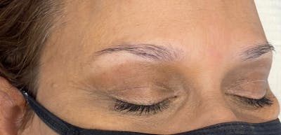 Microblading Before & After Gallery - Patient 143521856 - Image 1
