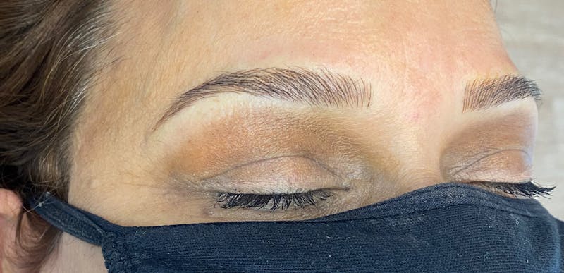 Microblading Before & After Gallery - Patient 143521856 - Image 2