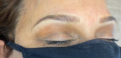 Microblading Before & After Gallery - Patient 143521856 - Image 2