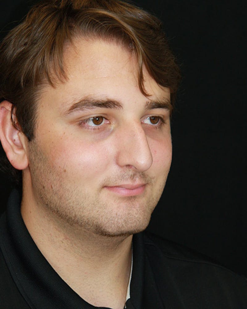 Rhinoplasty Before & After Gallery - Patient 143521986 - Image 3