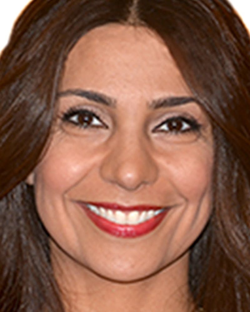 Rhinoplasty Before & After Gallery - Patient 143522088 - Image 2