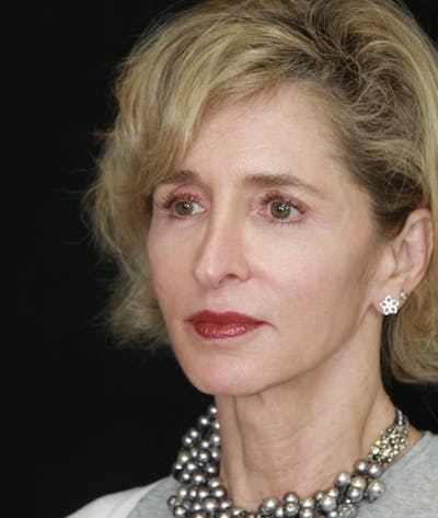 Facelift & Neck Lift Before & After Gallery - Patient 178840008 - Image 1