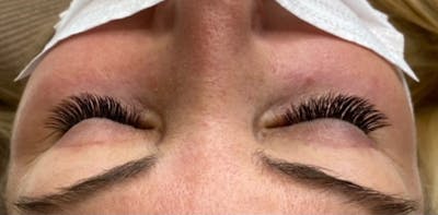 Eyelash Extensions Before & After Gallery - Patient 181016901 - Image 2