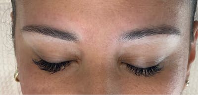 Microblading Before & After Gallery - Patient 143521839 - Image 1