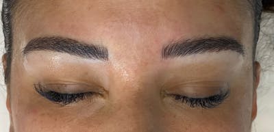 Microblading Before & After Gallery - Patient 143521839 - Image 2