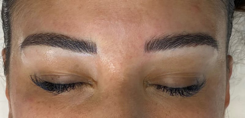 Microblading Before & After Gallery - Patient 143521839 - Image 2