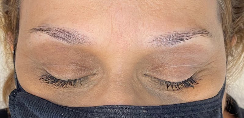Microblading Before & After Gallery - Patient 143521853 - Image 1