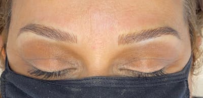 Microblading Before & After Gallery - Patient 143521853 - Image 2