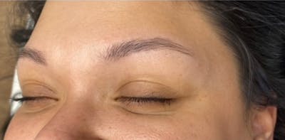 Microblading Before & After Gallery - Patient 181016956 - Image 1