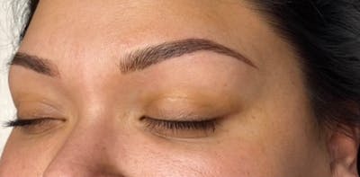 Microblading Before & After Gallery - Patient 181016956 - Image 2