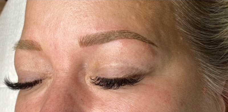 Microblading Before & After Gallery - Patient 181016984 - Image 2
