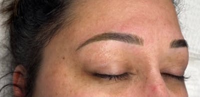 Microblading Before & After Gallery - Patient 181017036 - Image 2