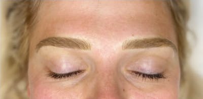 Microblading Before & After Gallery - Patient 181019958 - Image 2