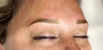Microblading Before & After Gallery - Patient 181020146 - Image 2