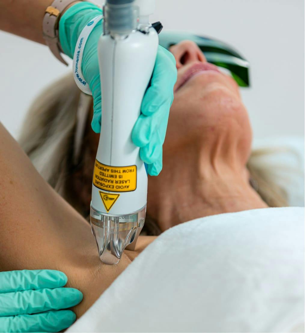 Laser hair removal treatment at Eleve Medspa.