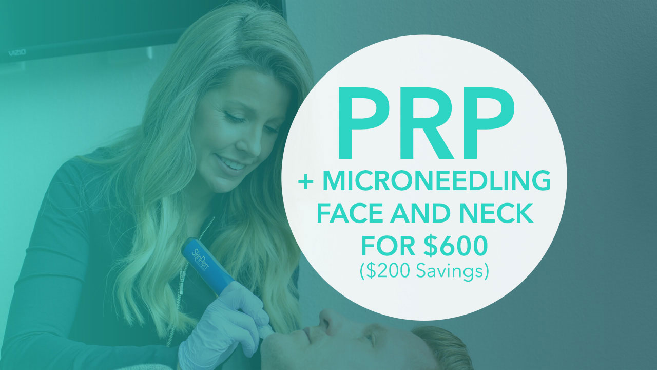 Picture of PRP Microneedling