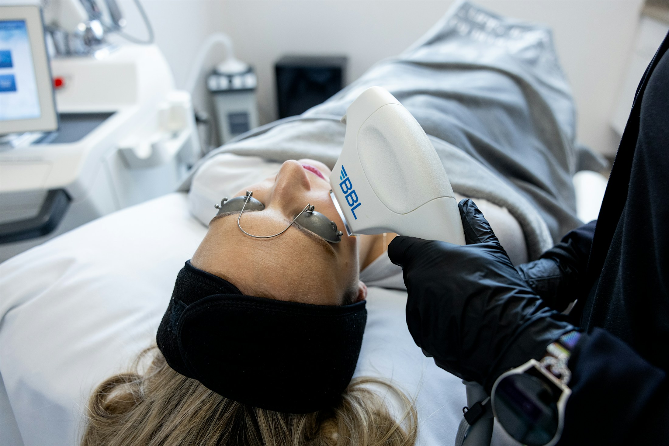 Woman receiving BBL facial rejuvenation