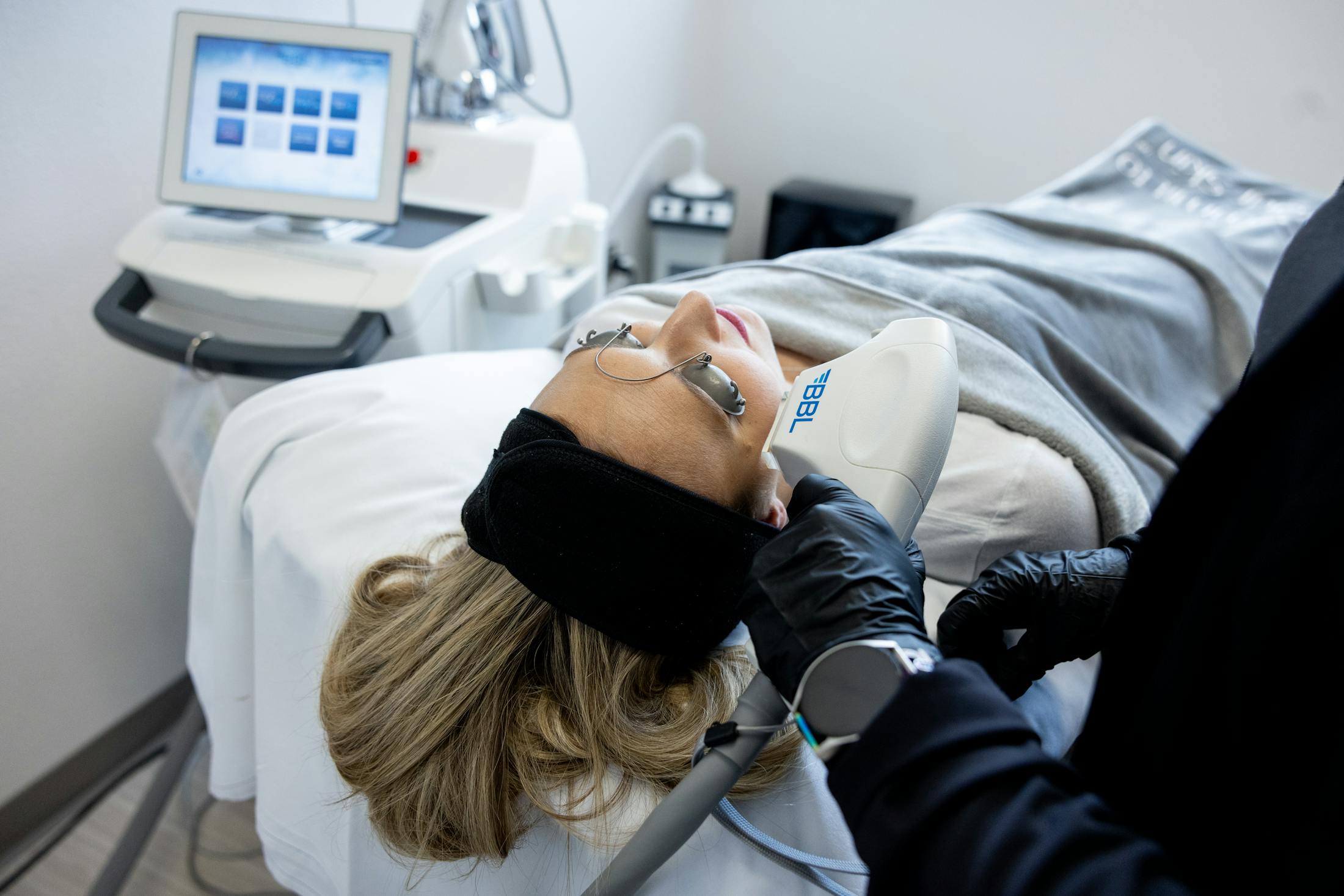Patient receiving BBL treatment
