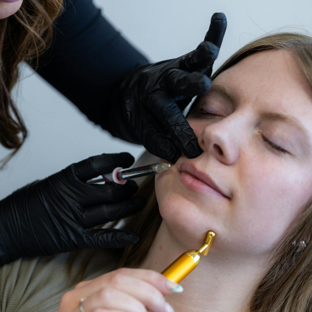 woman receiving lip filler