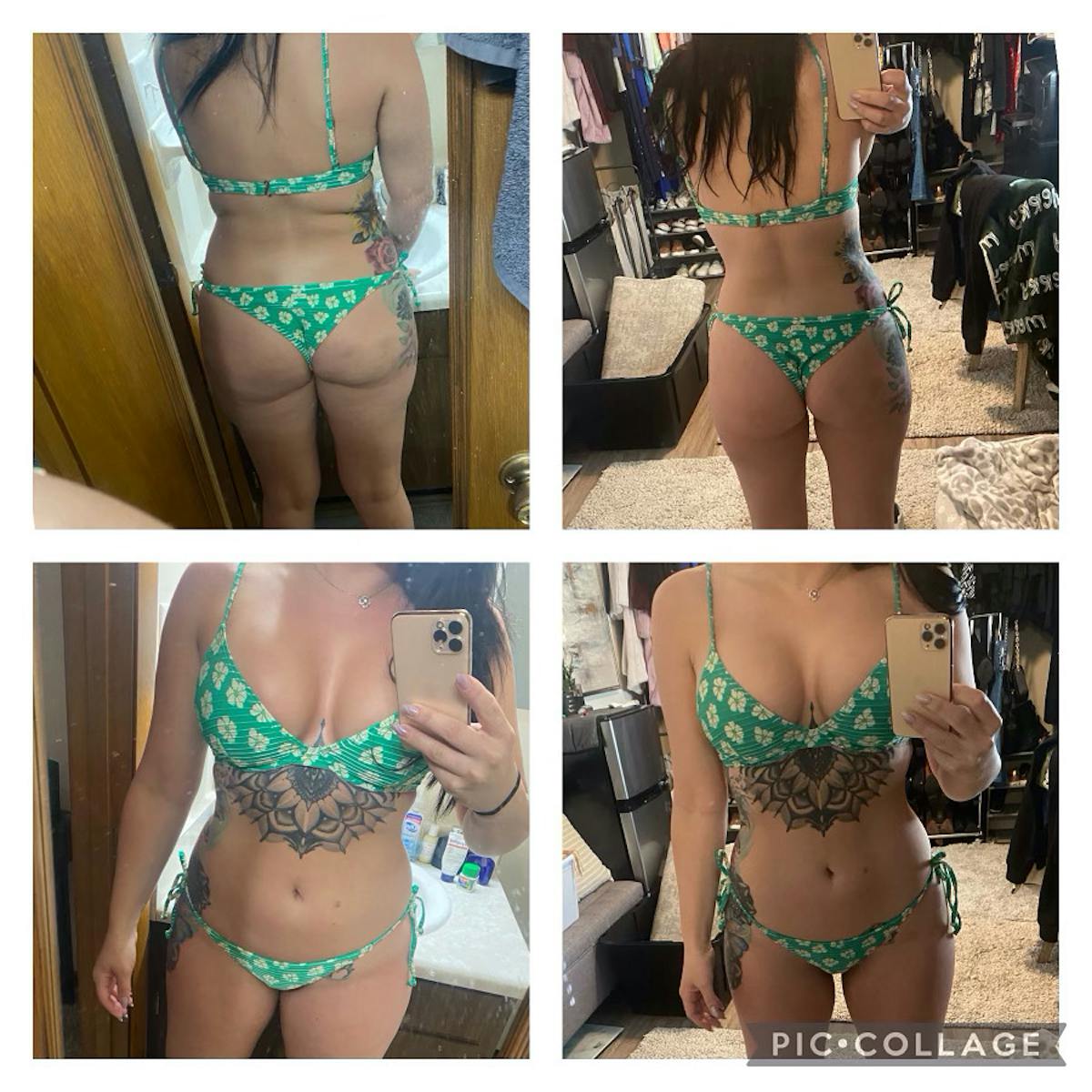 Semaglutide Before & After Gallery - Patient 186756379 - Image 2