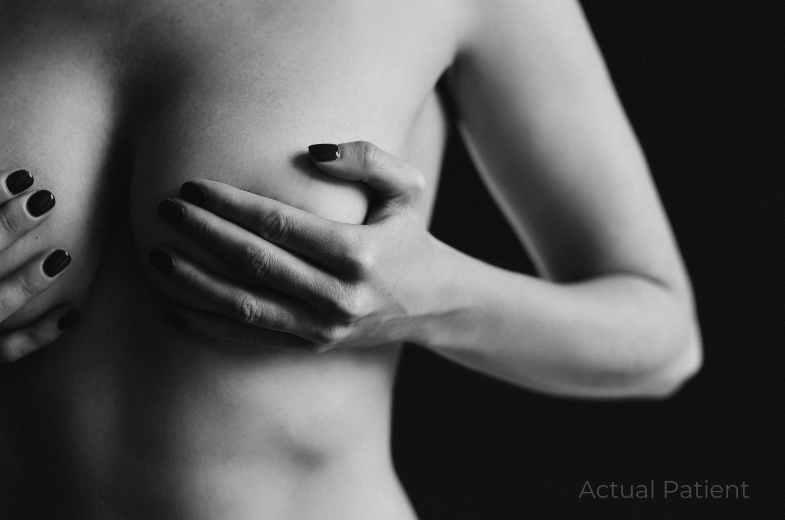 breast augmentation