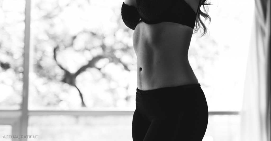 Top 7 Questions to Ask Your Tummy Tuck Surgeon Austin, TX The