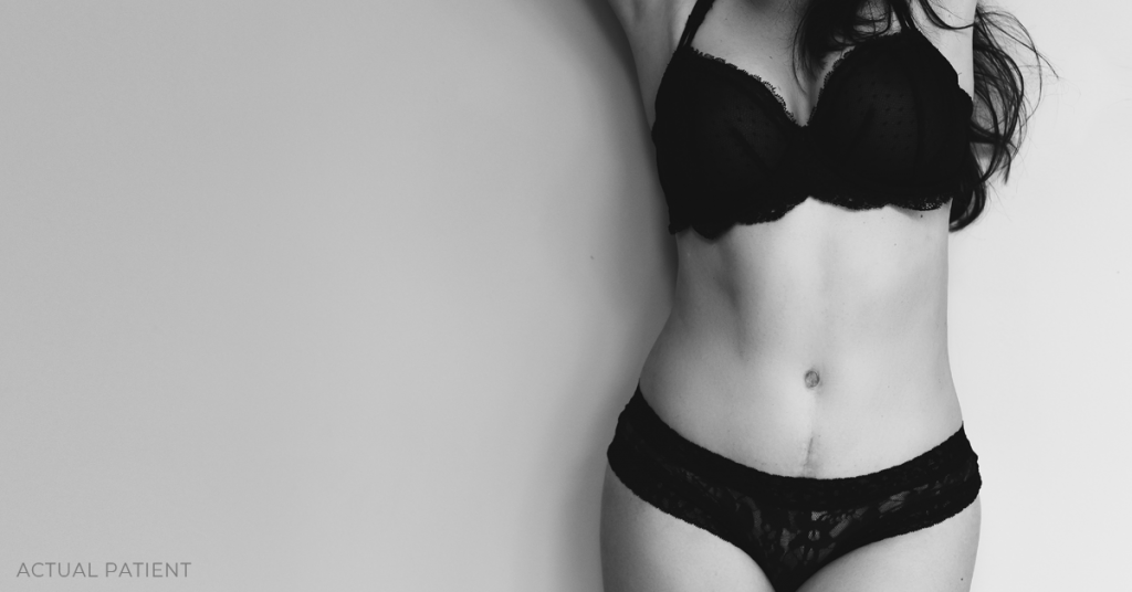 Black and white picture of woman in bra and panties