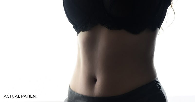 Woman's abdominal area
