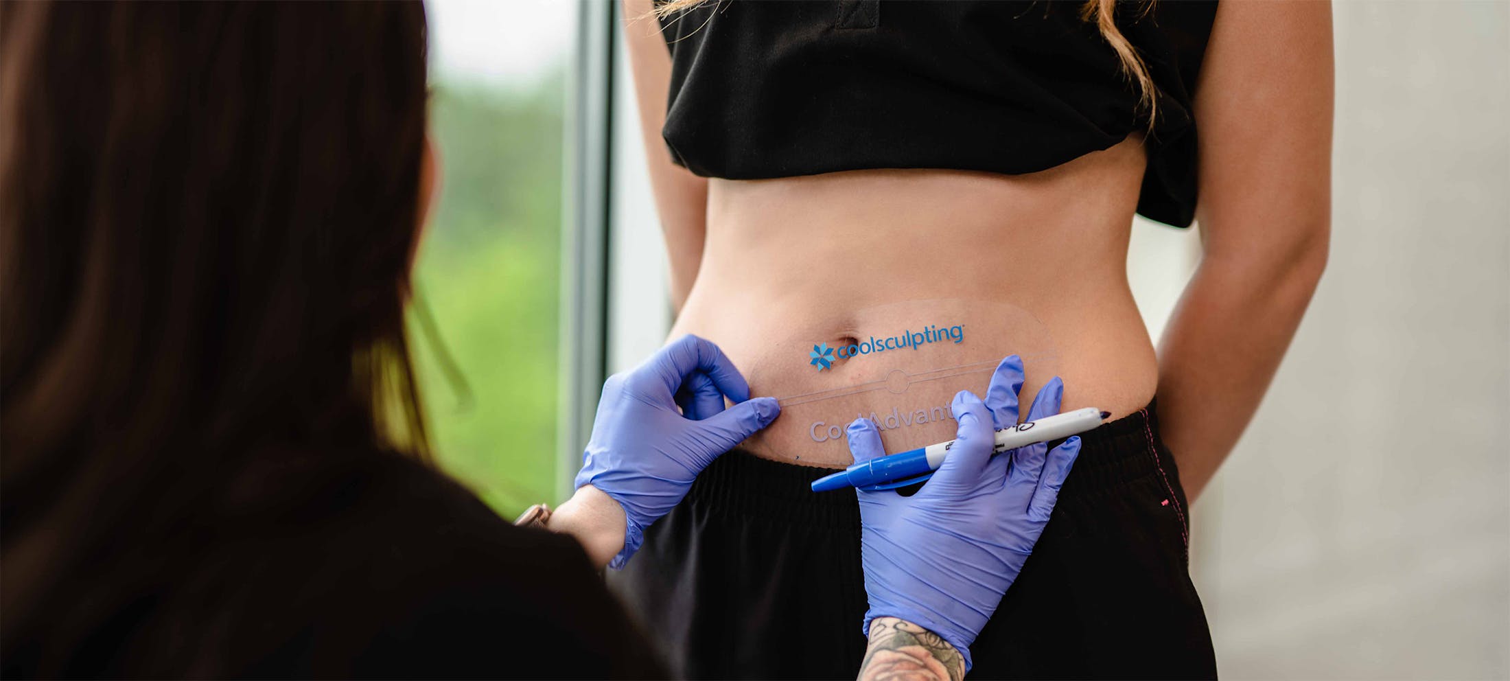 Woman prepping for CoolSculpting treatment