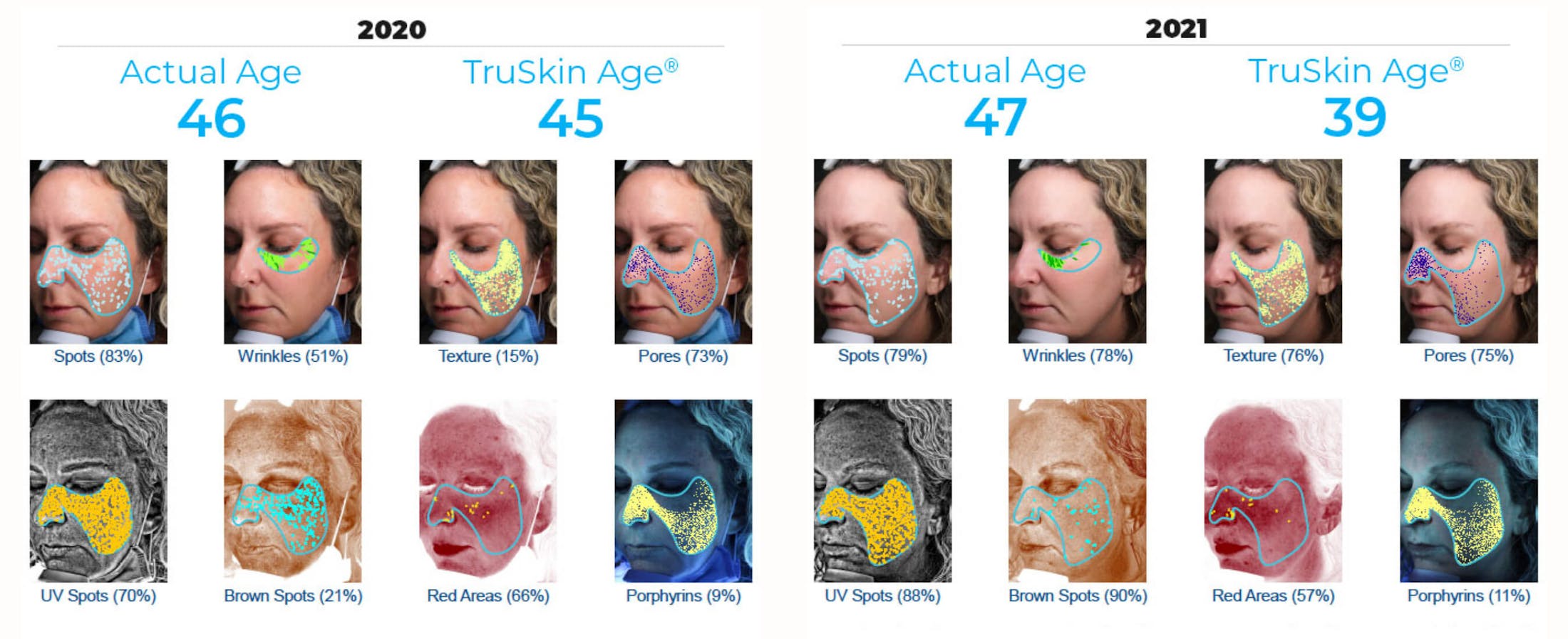 Image of skin analysis comparisons