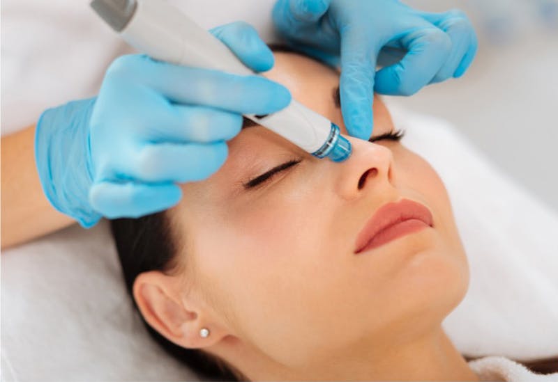 Clearskin Acne Treatment