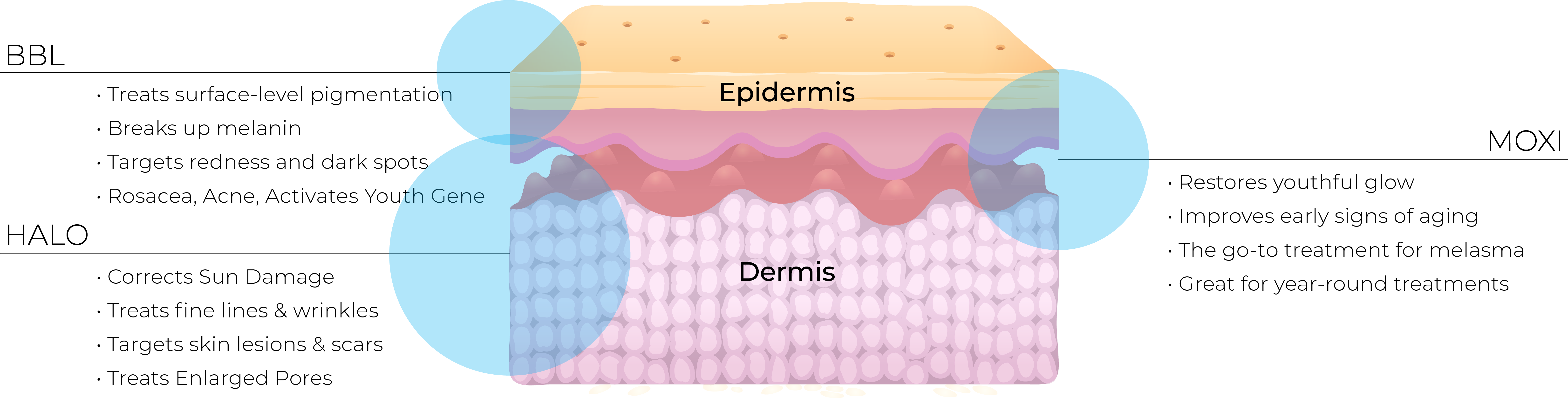 Infographic showing the layers of skin Moxi Halo BBL lasers