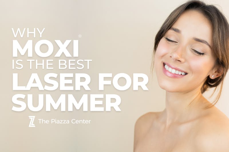 Moxi Laser in Summer