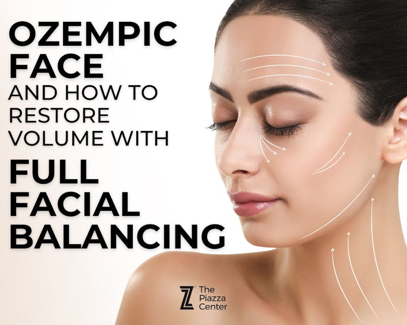 How to fix Ozempic Face with full facial balancing