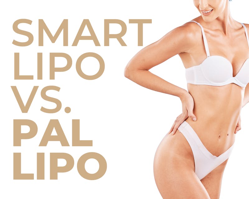 Laser Lipo vs Taditional Liposuction