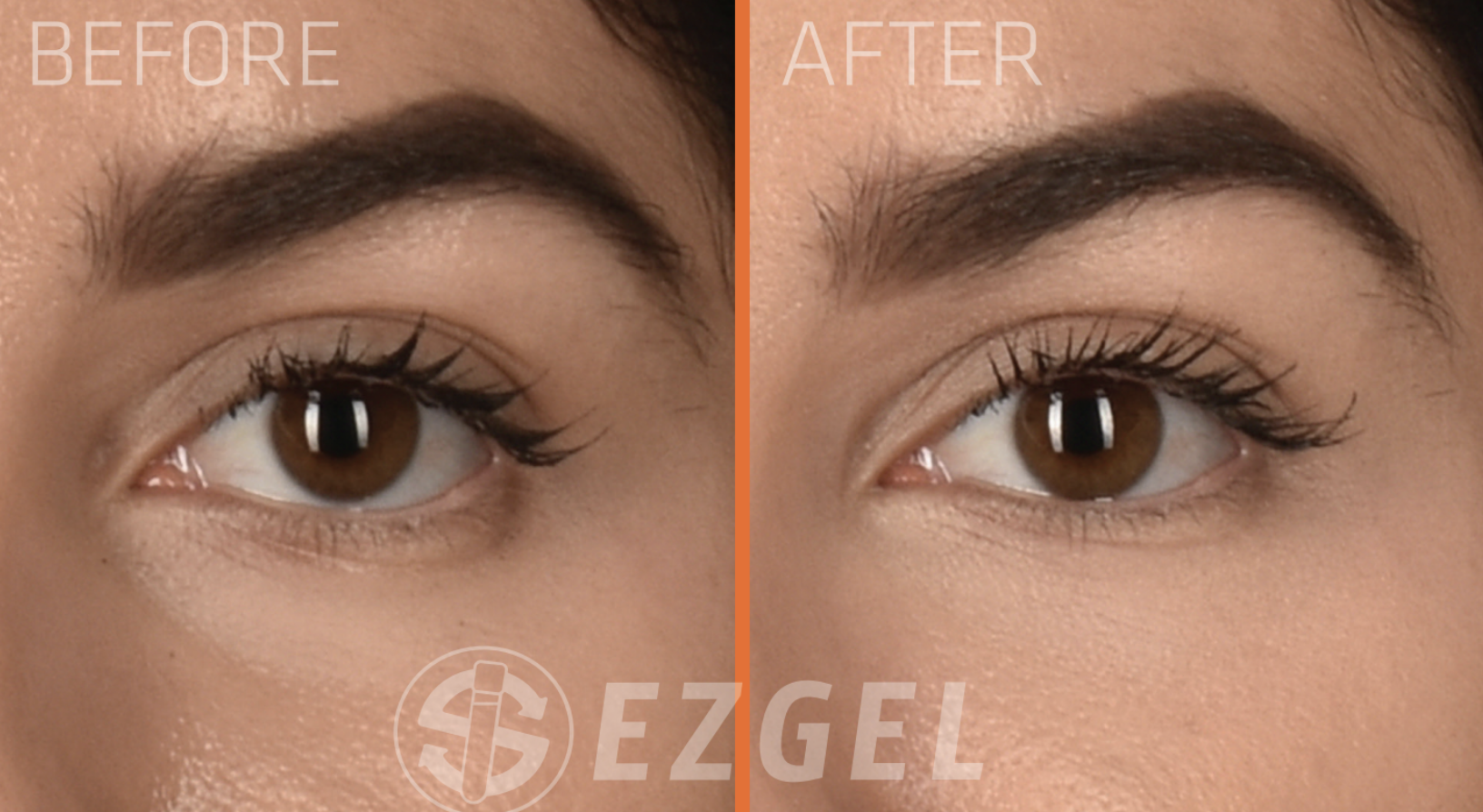 ezGEL results under the eye