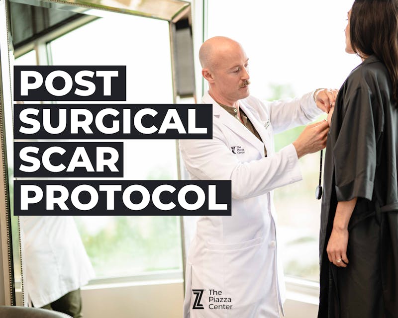 Scar Protocol post Plastic Surgery