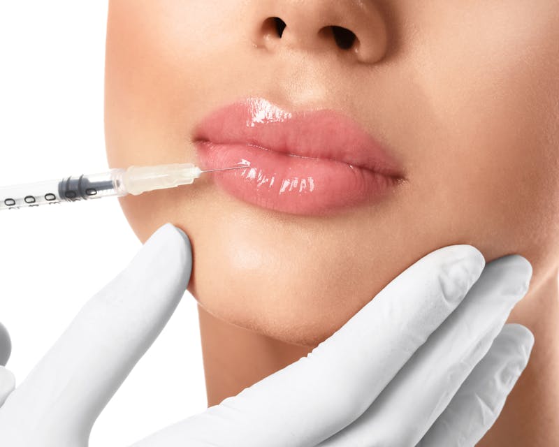 Lip Filler in Austin, TX