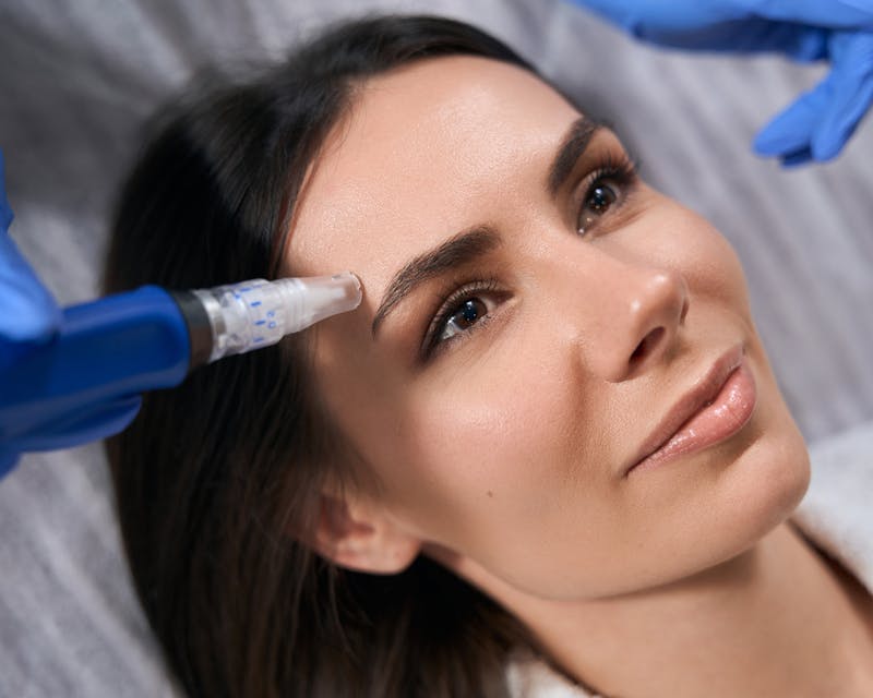 Microneedling in Austin Texas